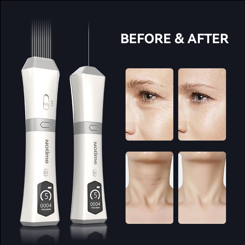 Notime Ultrasonic Anti-Aging Face Lift Device – Wrinkle Reduction & Skin Tightening